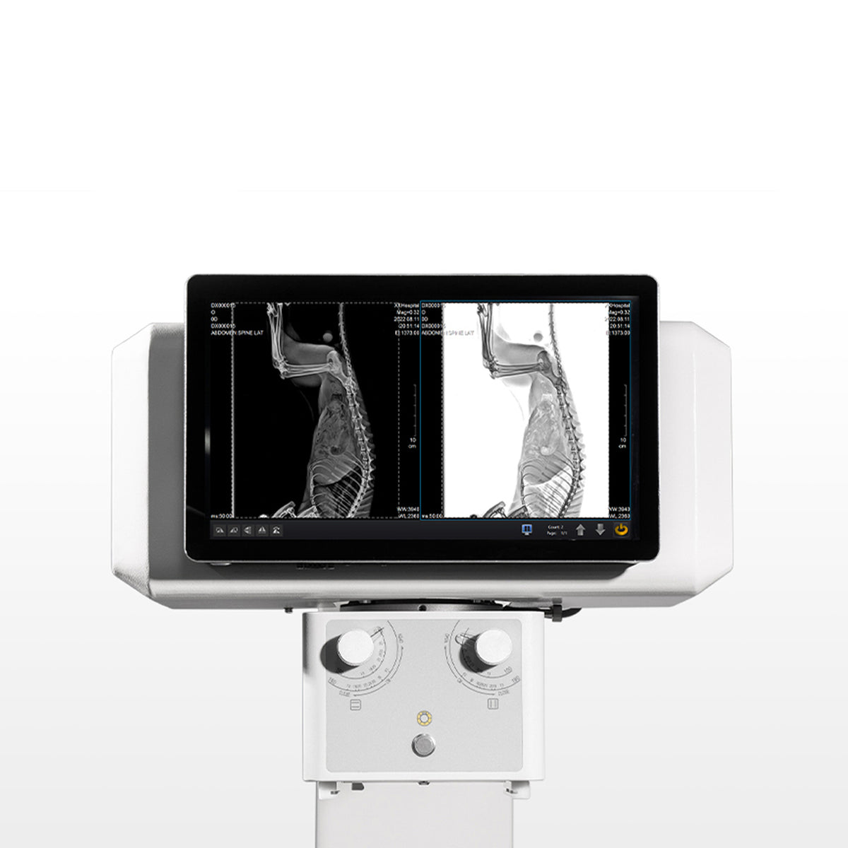 Browiner VX200/VX400 Veterinary X-ray