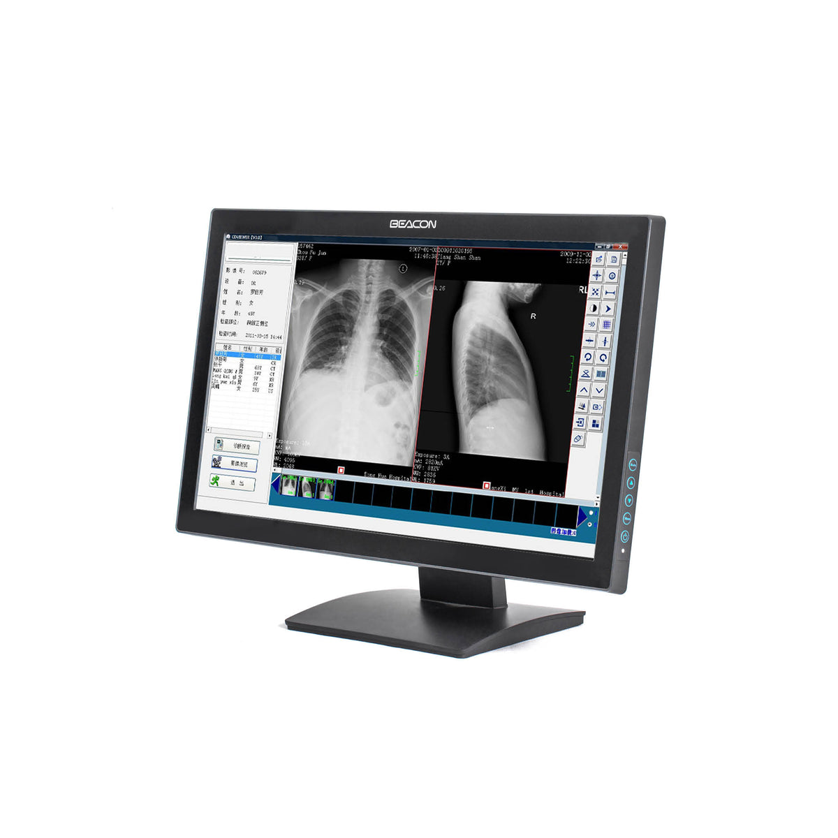 Beacon Endoscopy & Surgical Monitors will ensure accurate image reproduction.