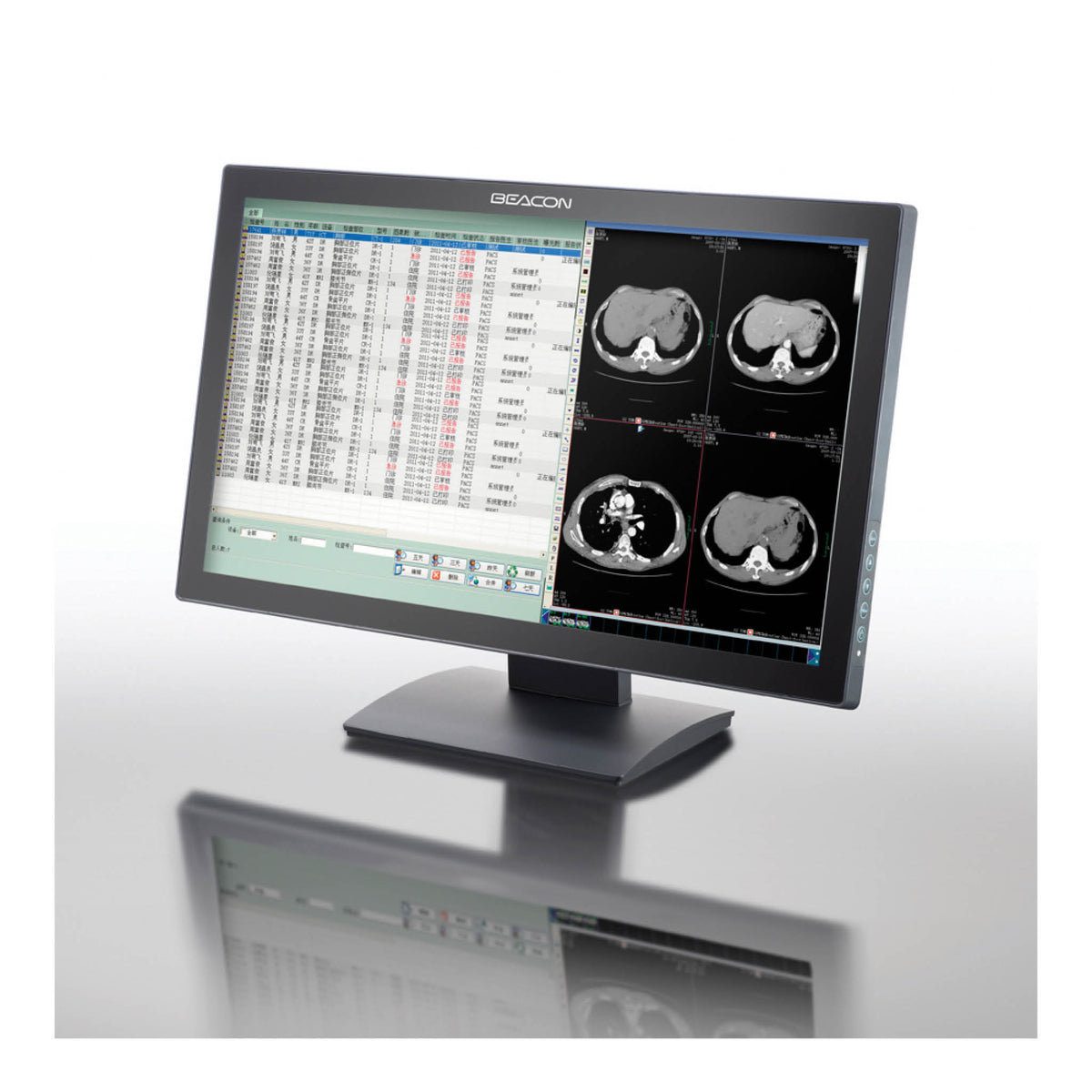 Beacon Endoscopy & Surgical Monitors will ensure accurate image reproduction.