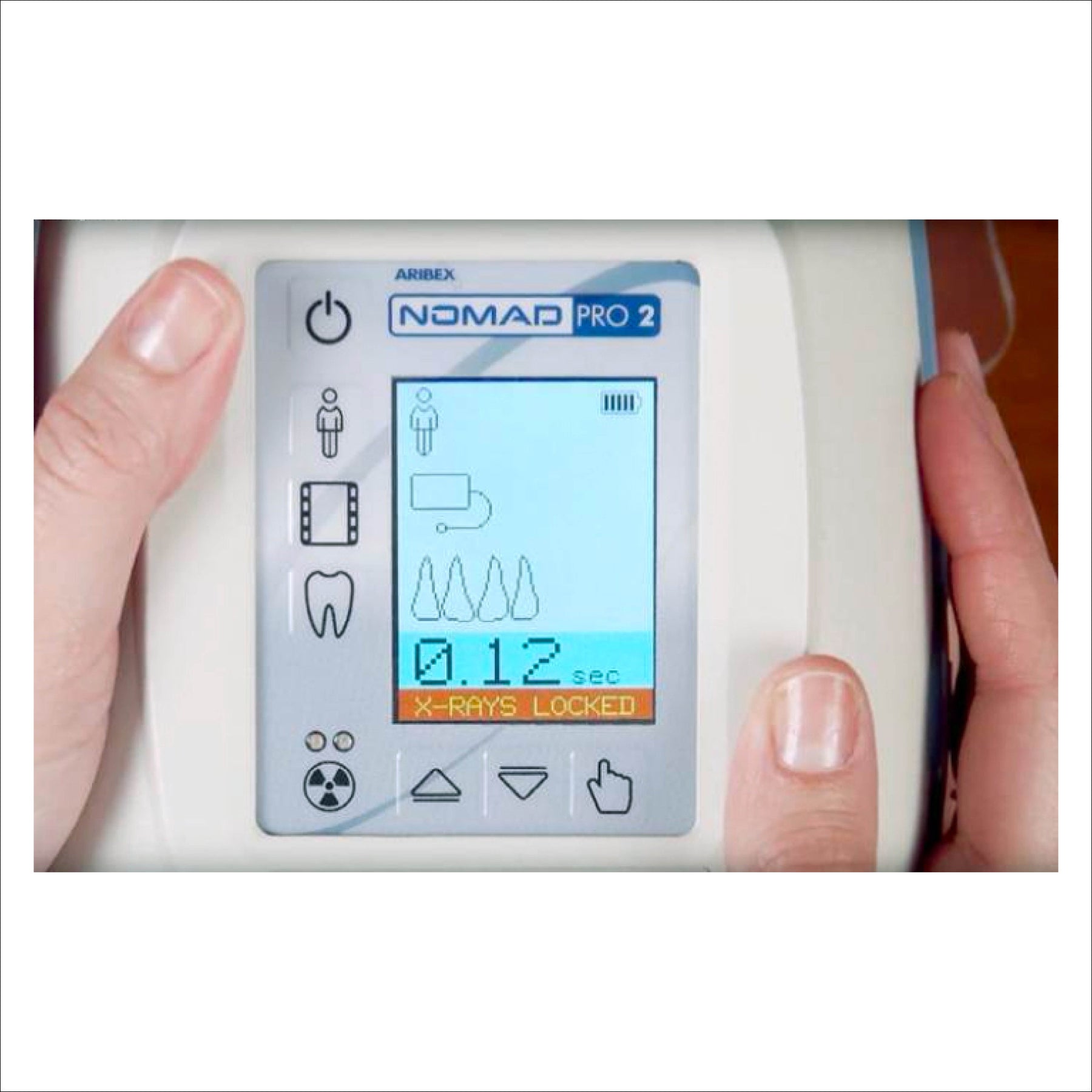 Dexis Nomad Vet handheld portable X-ray