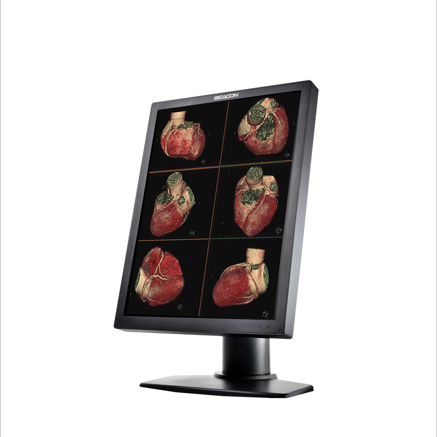 Beacon Endoscopy & Surgical Monitors will ensure accurate image reproduction.