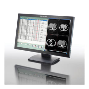 Beacon Endoscopy & Surgical Monitors will ensure accurate image reproduction.