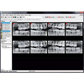 DentalEye Imaging Software high performance X-ray software