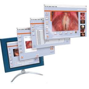 The Ecleris LED Strobsocope when combined with ENDODIGI (Video/Image Documentation) offers the best value for stroboscopy in the market today.