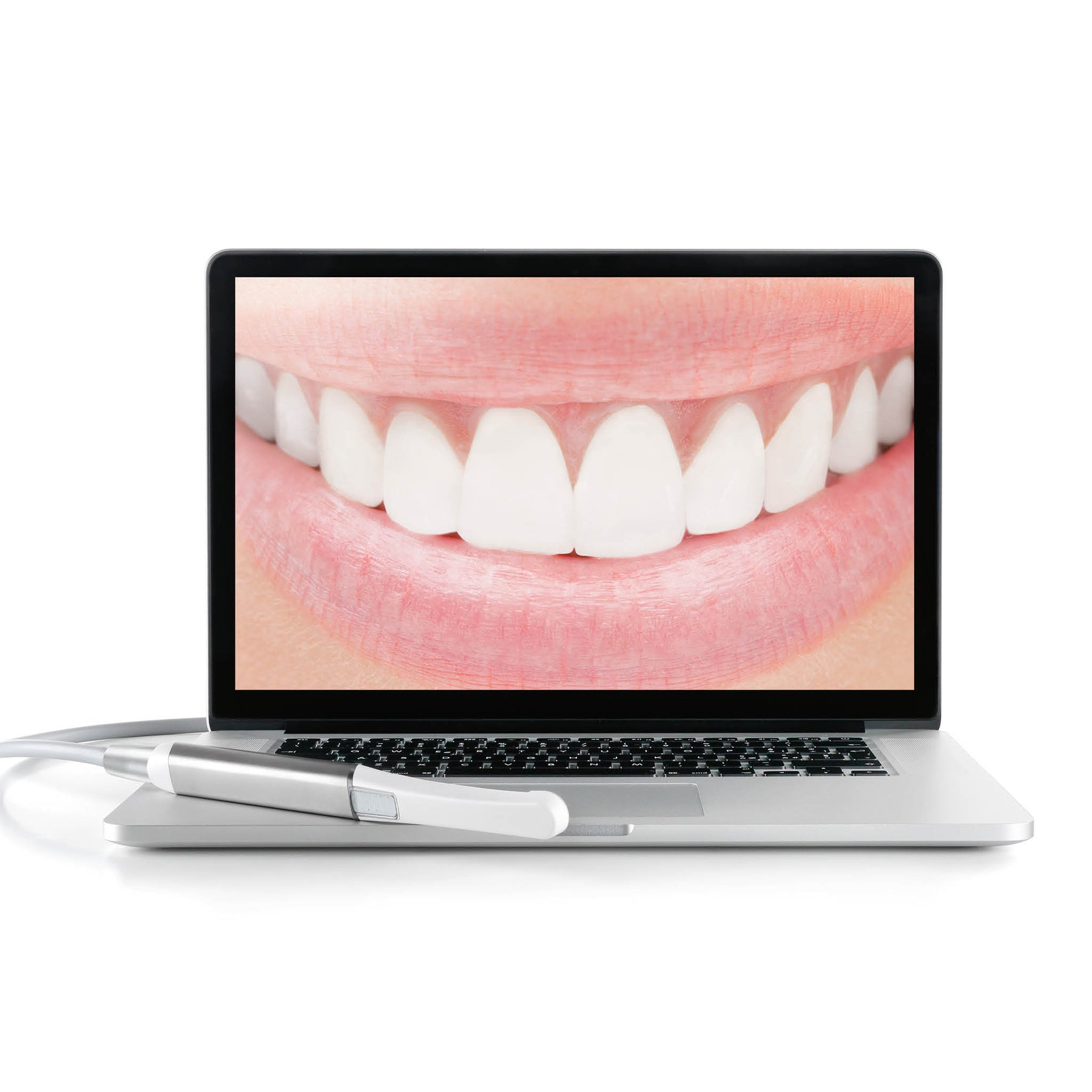 MyRay C-U2 Intraoral Camera with laptop and image on screen