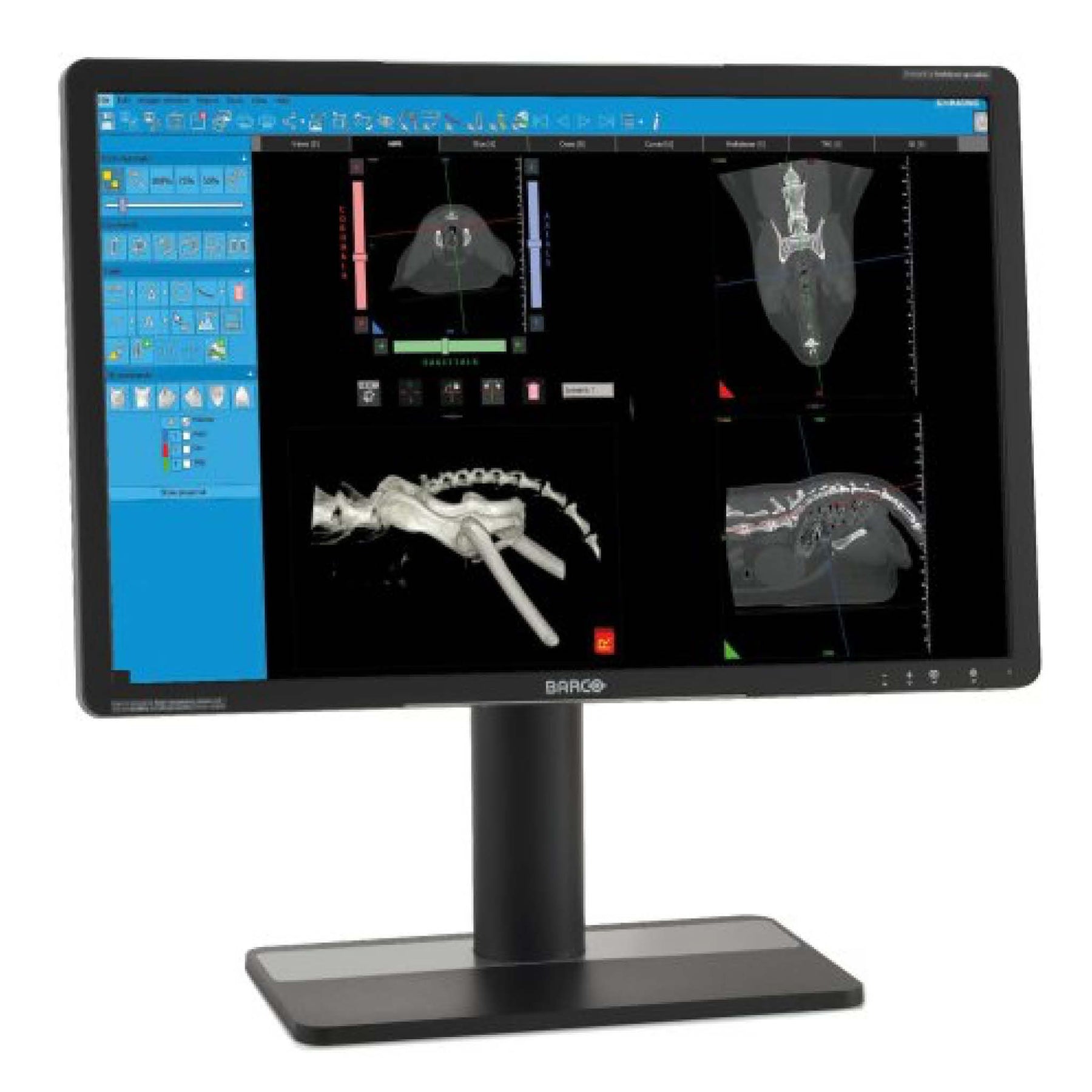 NewTom 7G Vet Cone Beam CT