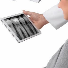 In just a few seconds, the NewTom X-PSP reader can import and digitalise images from phosphorous film plates in rapid sequence, allowing their immediate display via the app, on an iPad.