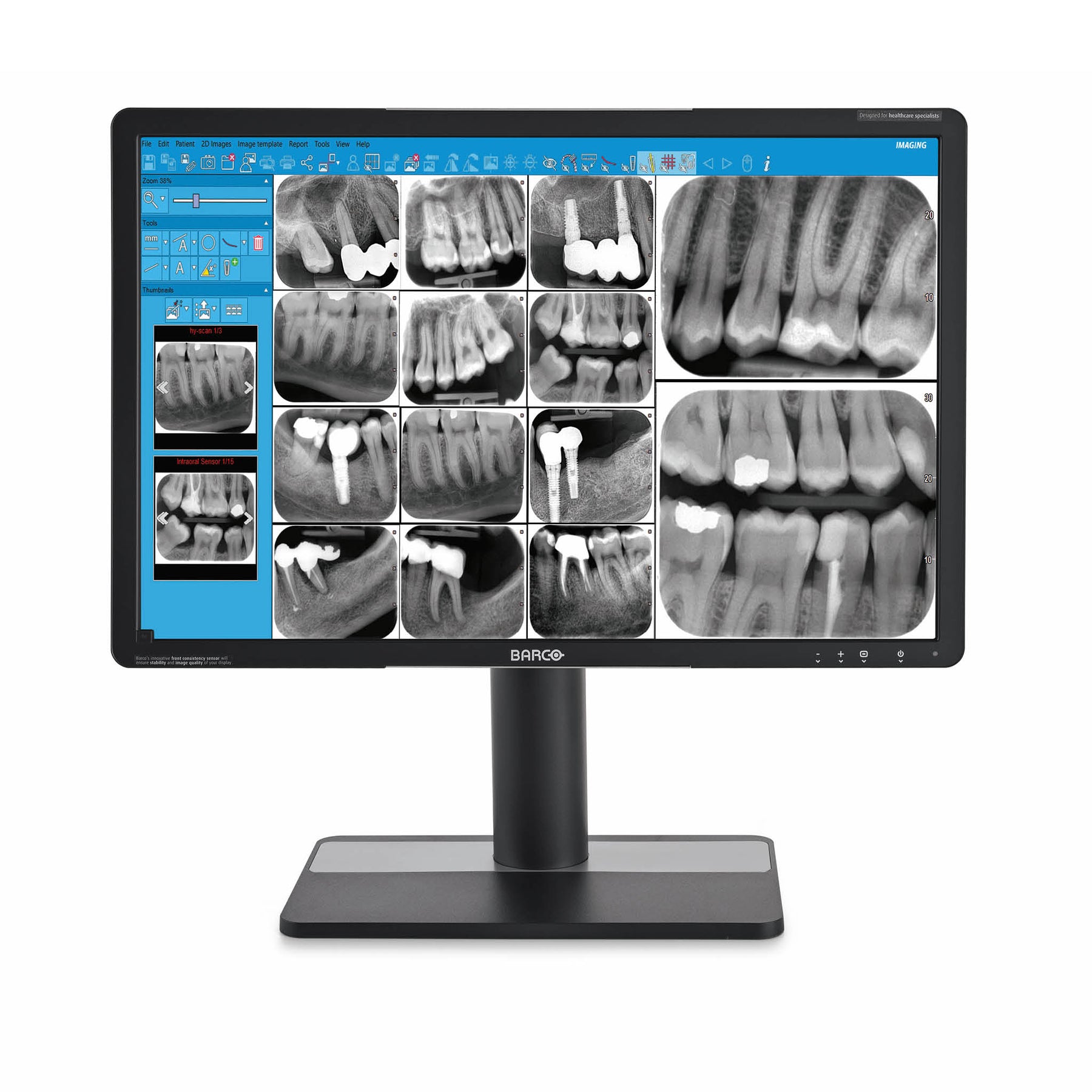 In just a few seconds, the NewTom X-PSP reader can import and digitalise images from phosphorous film plates in rapid sequence, allowing their immediate display on PC