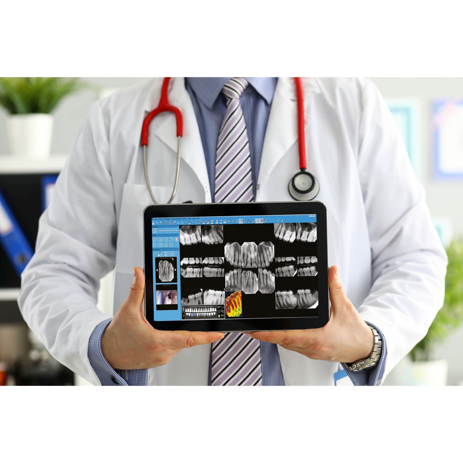 NEWTOM RX DC Intraoral X-ray - Wall or trolley mount available.