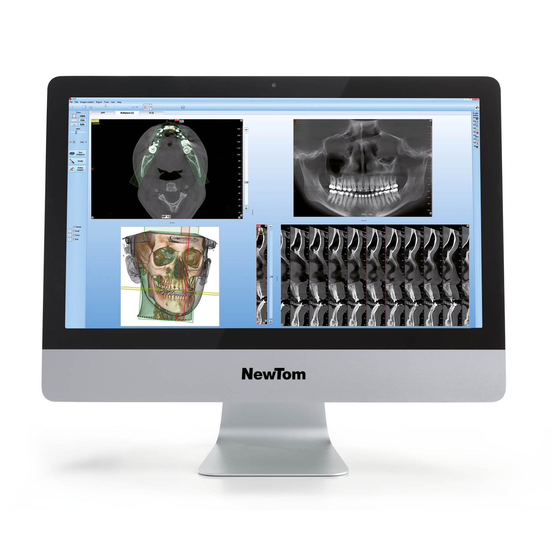 NewTom VGi Evo, the complete maxillofacial/ENT Cone Beam CT. It boasts extraordinary performance and the ultimate quality 2D and 3D images for perfect diagnoses.