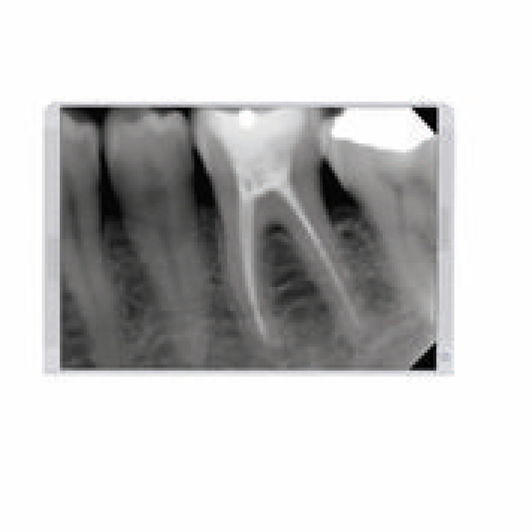 NewTom X-VS Sensor High Quality, Low Dose Dental Diagnostics