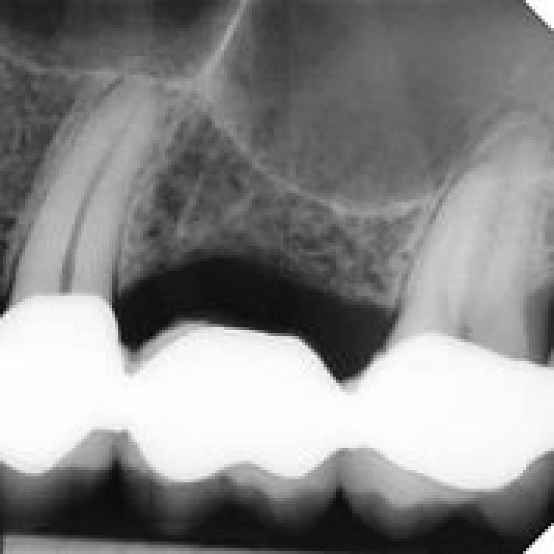 NewTom X-VS Sensor High Quality, Low Dose Dental Diagnostics