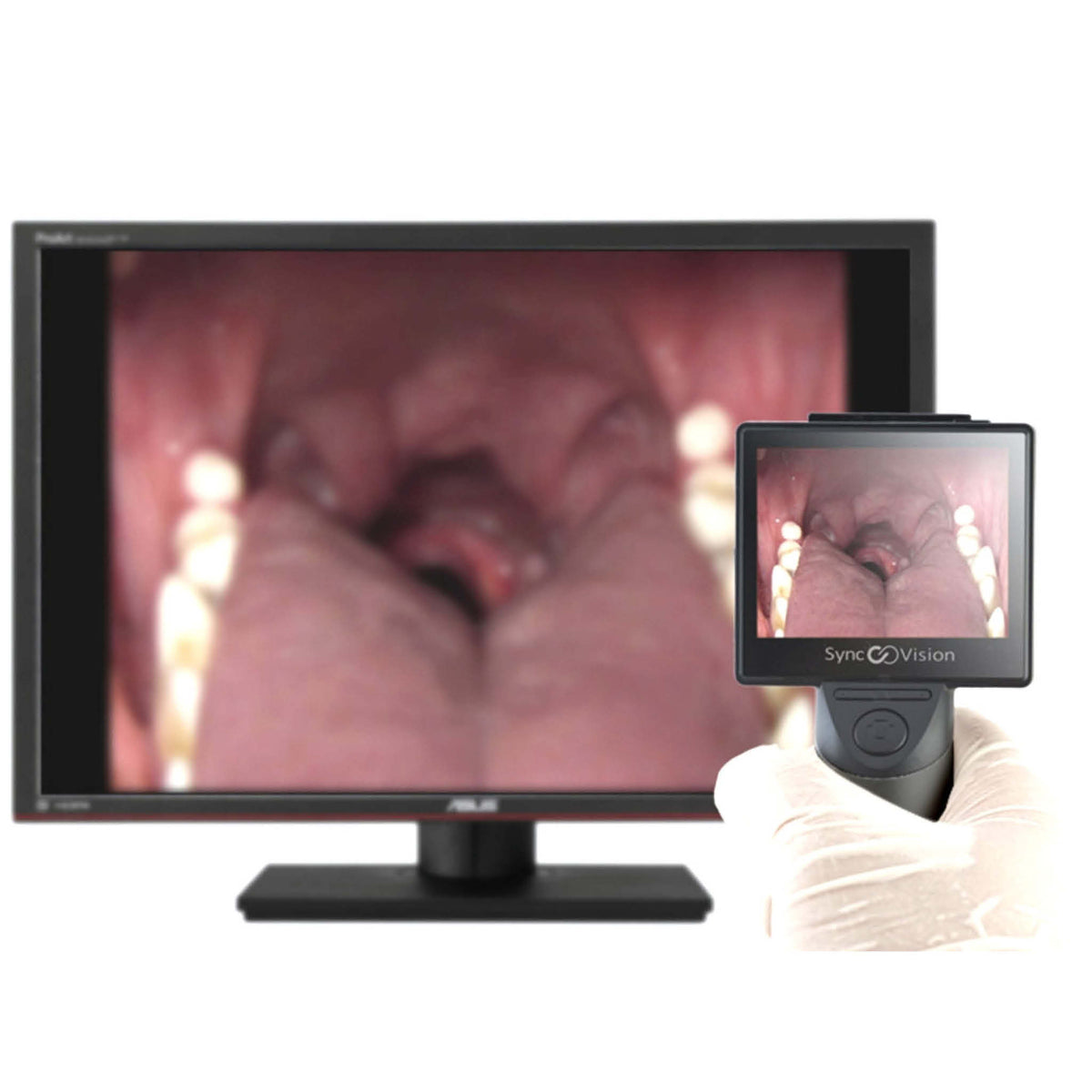 Syncvision iO1 Vet Pro Endoscope Camera