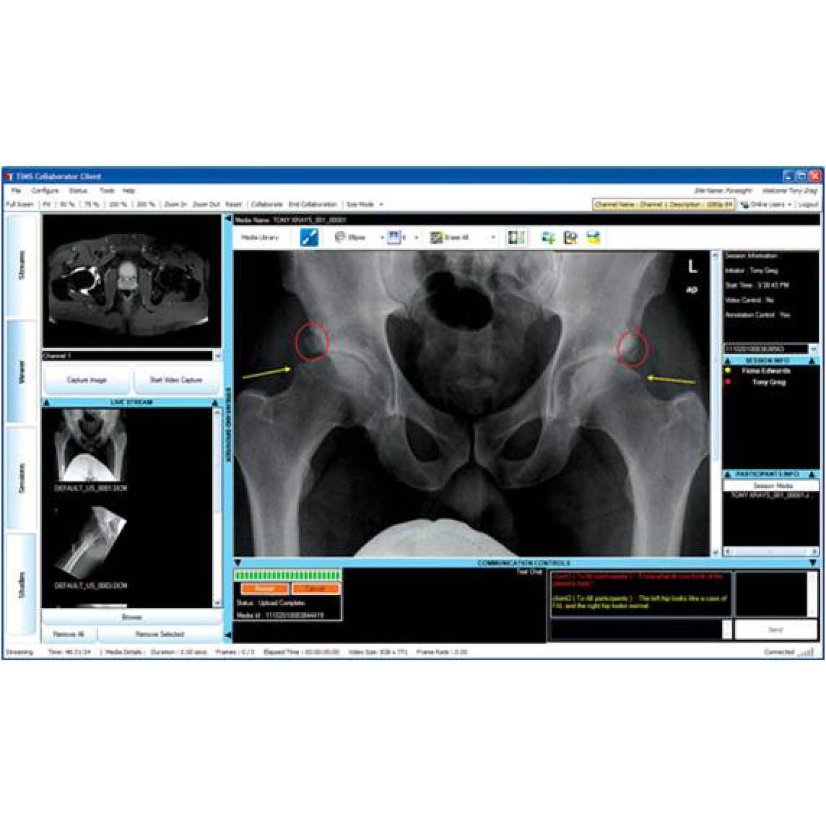TIMS MVP Diagnostic Imaging Recording & Editing for Swallow Studies